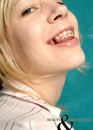 Beauty And Braces